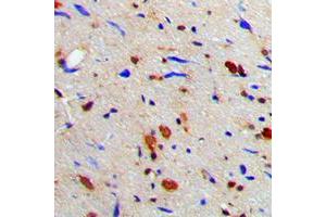 Immunohistochemical analysis of MGCRACGAP staining in human brain formalin fixed paraffin embedded tissue section. (RACGAP1 antibody  (N-Term))