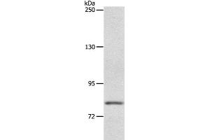 Western Blot analysis of Mouse liver tissue using ABCB6 Polyclonal Antibody at dilution of 1:250 (ABCB6 antibody)
