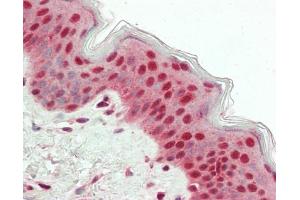 Human Skin: Formalin-Fixed, Paraffin-Embedded (FFPE) (USP7 antibody  (AA 1-50))