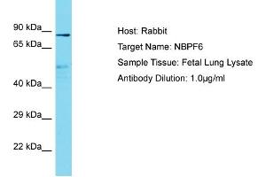 Host: Rabbit Target Name: NBPF6 Sample Type: Fetal Lung lysates Antibody Dilution: 1.