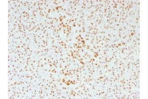 Formalin-fixed, paraffin-embedded human Pancreas stained with ATRX Mouse Monoclonal Antibody (39f). (ATRX antibody)