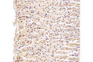 Immunohistochemistry of paraffin embedded human stomach using DDX19B (ABIN7073694) at dilution of 1: 1000 (400x lens)