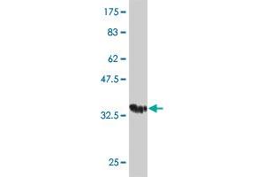 Western Blot detection against Immunogen (35. (GCAP1 antibody  (AA 1-93))