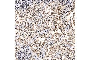 IHC analysis of SAE1 using anti-SAE1 antibody (ABIN7601346). (SAE1 antibody  (AA 33-299))