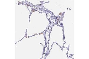 Immunohistochemical staining (Formalin-fixed paraffin-embedded sections) of human lung with FCGR3A polyclonal antibody  shows positivity in macrophages. (FCGR3A antibody  (AA 227-254))