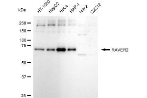 Western blotting analysis using RAVER2 antibody (ABIN7800211).