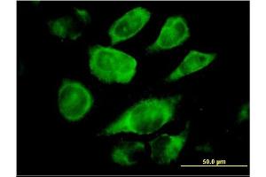 Immunofluorescence of monoclonal antibody to SSR4 on HeLa cell. (SSR4 antibody  (AA 24-173))