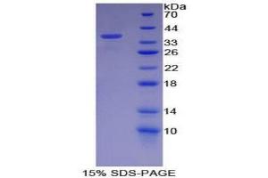 SDS-PAGE (SDS) image for Neurofibromin 2 (NF2) (AA 30-311) protein (His tag) (ABIN2126043)
