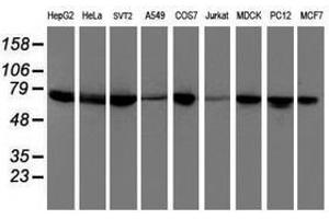 Image no. 2 for anti-Dystrobrevin, beta (DTNB) antibody (ABIN1497915) (Dystrobrevin beta antibody)