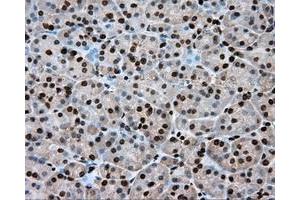 Immunohistochemical staining of paraffin-embedded Kidney tissue using anti-ERCC1 mouse monoclonal antibody. (ERCC1 antibody)