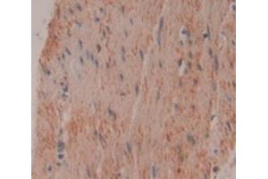 IHC-P analysis of Human Tissue, with DAB staining. (TNNI1 antibody  (AA 1-187))