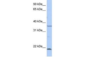 WB Suggested Anti-SPRY2 Antibody Titration: 0. (SPRY2 antibody  (Middle Region))