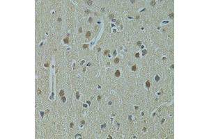 Immunohistochemistry of paraffin-embedded rat brain using UBE2I antibody. (UBE2I antibody  (AA 1-158))