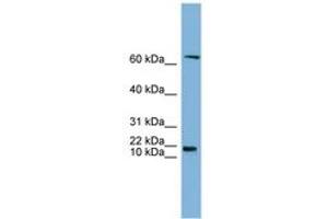 Image no. 1 for anti-GM2 Ganglioside Activator (GM2A) (N-Term) antibody (ABIN6743402)
