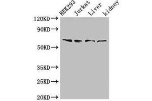 Western Blot Positive WB detected in: HEK293 whole cell lysate, Jurkat whole cell lysate, Rat liver tissue, Rat kidney tissue All lanes: TXK antibody at 3 μg/mL Secondary Goat polyclonal to rabbit IgG at 1/50000 dilution Predicted band size: 62 kDa Observed band size: 62 kDa (TXK antibody  (AA 32-83))