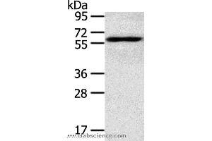 Western blot analysis of TM4 cell, using RORA Polyclonal Antibody at dilution of 1:400
