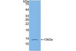 Detection of Recombinant C4b, Human using Polyclonal Antibody to Complement C4-B (C4B) (C4B antibody  (AA 680-756))