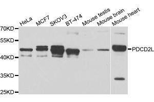 Western blot analysis of extracts of various cell lines, using PDCD2L antibody. (PDCD2L antibody)