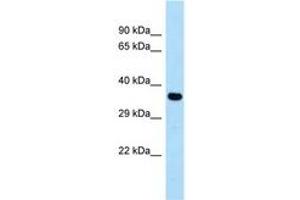 Image no. 1 for anti-Cysteinyl Leukotriene Receptor 1 (CYSLTR1) (AA 199-248) antibody (ABIN6747993) (CysLTR1 antibody  (AA 199-248))