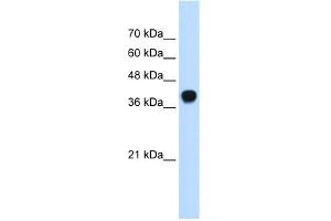 WB Suggested Anti-SQLE Antibody Titration: 0.
