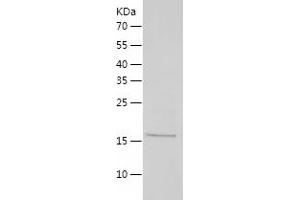 Interleukin 2 (IL2) (AA 21-169) (Active) protein (His tag)
