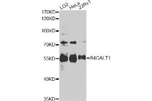 Western blot analysis of extracts of various cell lines, using B4GALT1 antibody. (B4GALT1 antibody)