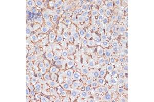 Immunohistochemistry of paraffin-embedded mouse liver using  antibody (ABIN6129926, ABIN6136997, ABIN6136998 and ABIN6218500) at dilution of 1:100 (40x lens). (APOA1 antibody  (AA 25-267))