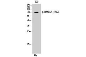 Western Blotting (WB) image for anti-Cell Division Cycle 25 Homolog A (S. Pombe) (CDC25A) (pSer124) antibody (ABIN3182248) (CDC25A antibody  (pSer124))