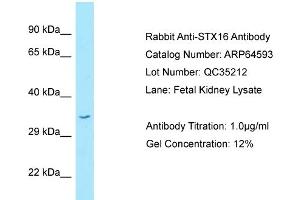 Western Blotting (WB) image for anti-Syntaxin 16 (STX16) (C-Term) antibody (ABIN2789888)