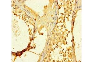 Immunohistochemistry of paraffin-embedded human testis tissue using ABIN7170528 at dilution of 1:100 (SPATS1 antibody  (AA 1-300))