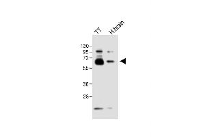 Western Blotting (WB) image for anti-delta Like Protein 3 (DLL3) (AA 545-573), (C-Term) antibody (ABIN656327)
