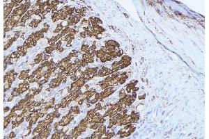 ABIN6277429 at 1/100 staining Human gastric tissue by IHC-P. (Peroxiredoxin 3 antibody  (Internal Region))