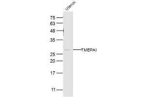 Mouse uterus lysates probed with TMEPAI Polyclonal Antibody, Unconjugated  at 1:300 dilution and 4˚C overnight incubation. (PMEPA1 antibody  (AA 21-120))