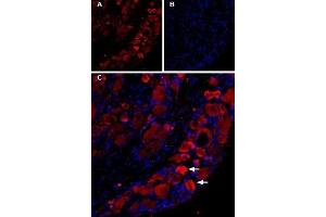 Expression of TRPV1 in rat DRGs - Immunohistochemical staining of TRPV1 in rat dorsal root ganglion (DRG) using Guinea pig Anti-TRPV1 (VR1) Antibody (ABIN7043840, ABIN7045432 and ABIN7045433), (1:200).