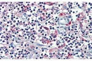Immunohistochemistry (IHC) image for anti-Macrophage Receptor with Collagenous Structure (MARCO) (AA 367-519) antibody (ABIN7444610)