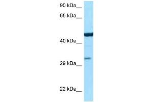 WB Suggested Anti-Asl Antibody Titration: 1.