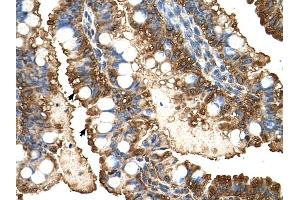 PGK1 antibody was used for immunohistochemistry at a concentration of 4-8 ug/ml to stain Epithelial cells of intestinal villus (arrows) in Human Intestine. (PGK1 antibody  (C-Term))