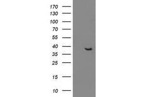 HEK293T cells were transfected with the pCMV6-ENTRY control (Left lane) or pCMV6-ENTRY DNAJB1 (Right lane) cDNA for 48 hrs and lysed. (DNAJB1 antibody)