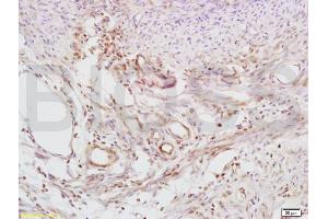 Formalin-fixed and paraffin embedded mouse uterus tissue labeled with Anti-Defensin-beta2/DEFB2/HBD-2 Polyclonal Antibody, Unconjugated (ABIN674574) at 1:200 followed by conjugation to the secondary antibody and DAB staining (beta 2 Defensin antibody  (AA 21-71))