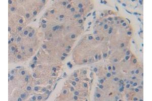 DAB staining on IHC-P; Samples: Human Stomach Tissue (Coagulation Factor V antibody  (AA 1979-2217))