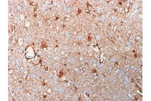 Formalin-fixed, paraffin-embedded human Brain stained with Purified S100B Mouse Recombinant Monoclonal Antibody (rS100B/1012). (Recombinant S100B antibody)