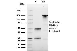 SDS-PAGE Analysis Purified Granzyme B Mouse Monoclonal Antibody (GZMB/3056).