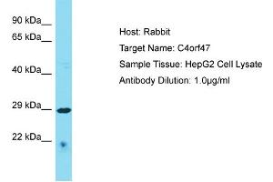 Host: Rabbit Target Name: C4orf47 Sample Type: HepG2 Whole Cell lysates Antibody Dilution: 1. (C4ORF47 antibody  (C-Term))