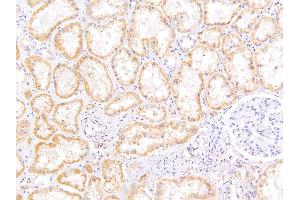 Immunohistochemistry (IHC) image for anti-ATP-Binding Cassette, Sub-Family C (CFTR/MRP), Member 5 (ABCC5) (N-Term) antibody (ABIN302162)