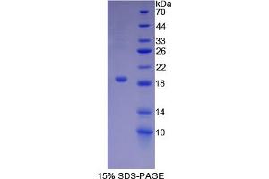 SDS-PAGE of Protein Standard from the Kit (Highly purified E. (Biglycan ELISA Kit)
