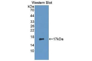 Detection of Recombinant MMP3, Human using Monoclonal Antibody to Matrix Metalloproteinase 3 (MMP3) (MMP3 antibody  (AA 363-477))