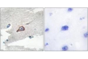 Immunohistochemistry (IHC) image for anti-Hemopoietic Cell Kinase (HCK) (AA 381-430) antibody (ABIN2888843)