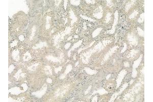ABIN6257066 and ABIN6275007 at 1/100 staining human normal kidney tissue by IHC-P. (CLIC4 antibody  (N-Term))