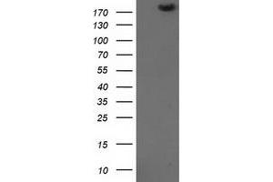 Image no. 1 for anti-SNF2 Histone Linker PHD RING Helicase, E3 Ubiquitin Protein Ligase (SHPRH) (AA 1-100) antibody (ABIN1490554) (SHPRH antibody  (AA 1-100))