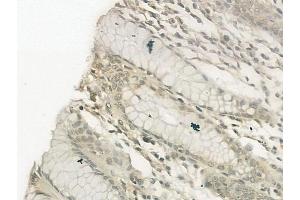 ABIN6257469 and ABIN6274751 at 1/100 staining human normal gastric tissue by IHC-P.